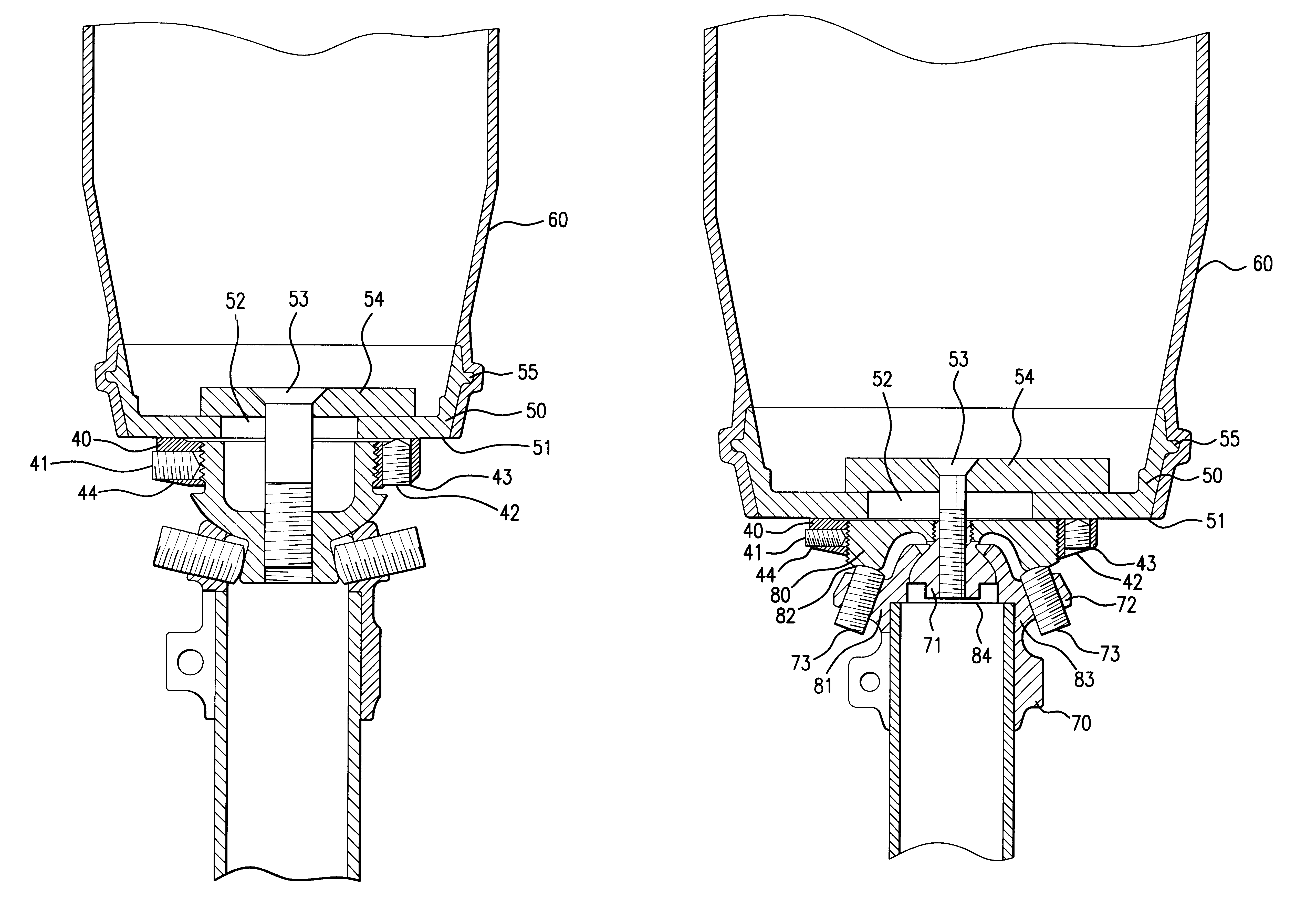 Locking device for a prothesis