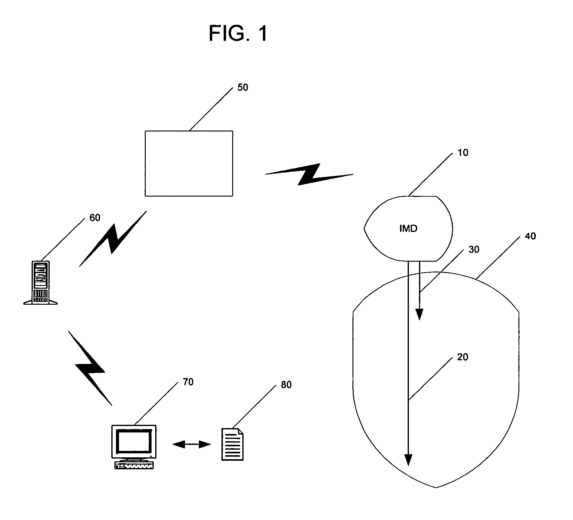 System and method of using AV conduction timing