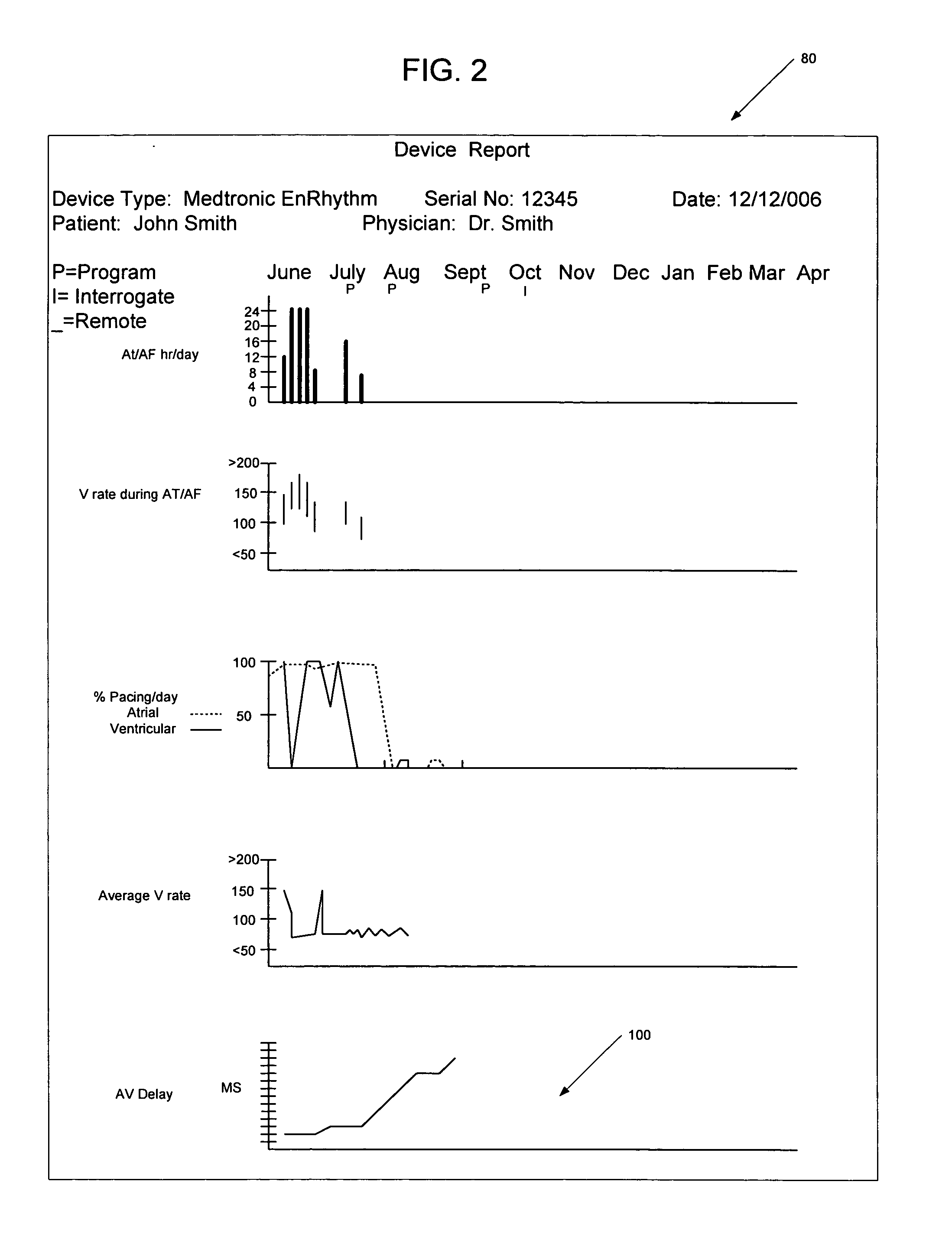 System and method of using AV conduction timing