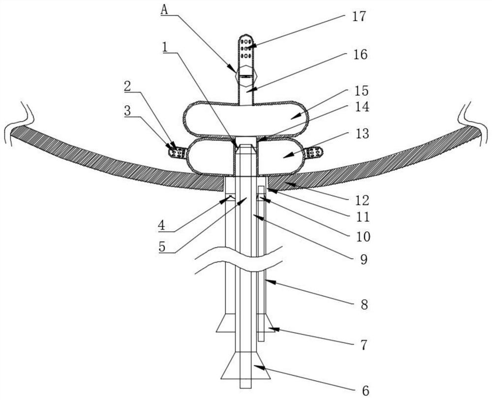 Novel bladder fistulization tube for urinary surgery