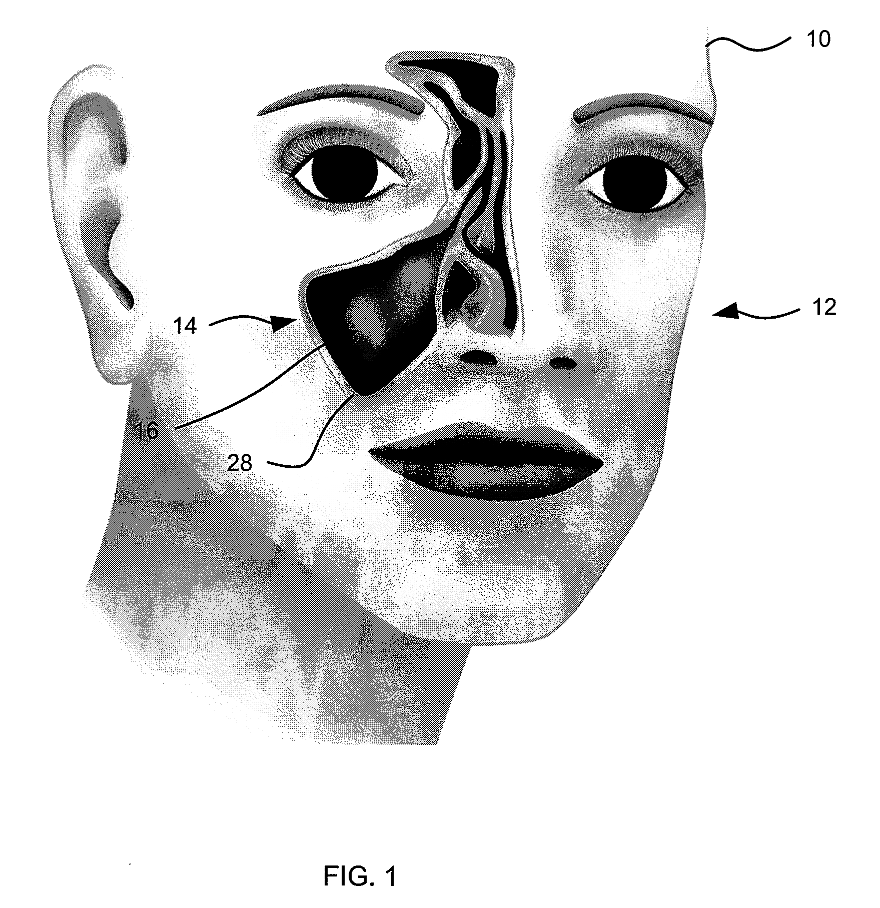 Apparatus and method for accessing a sinus cavity