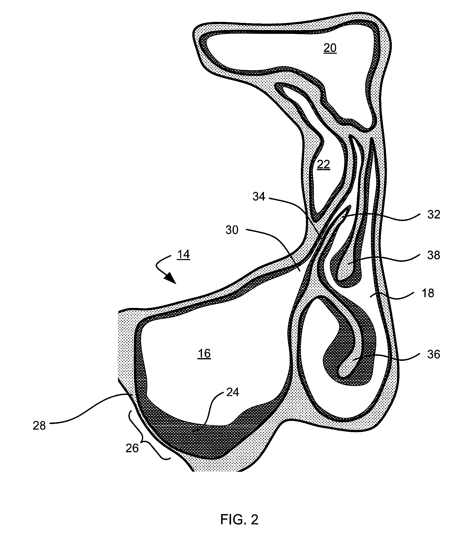 Apparatus and method for accessing a sinus cavity