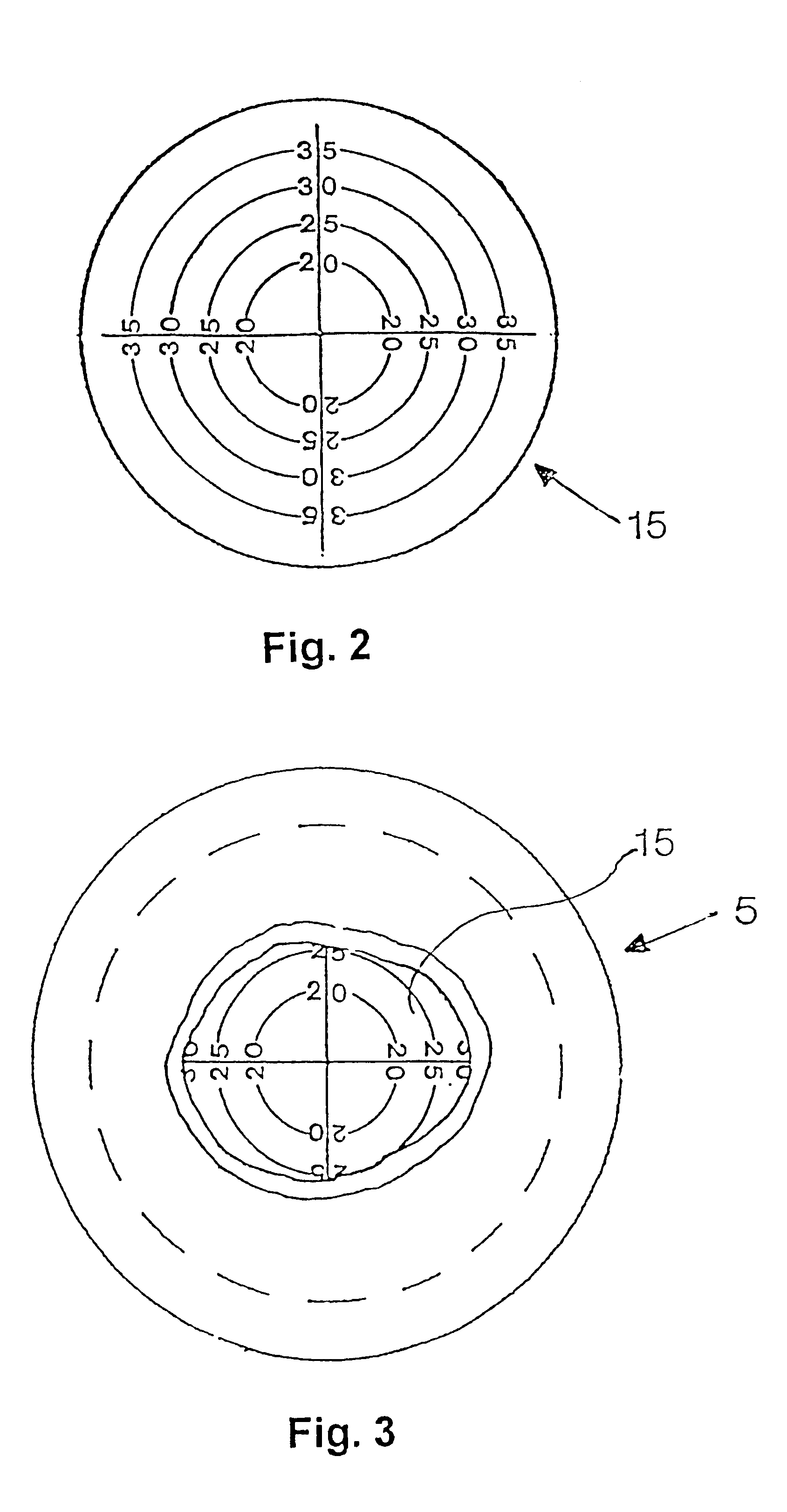 Ostomy appliance