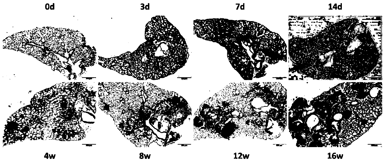 Improving method for preparing mouse silicosis model