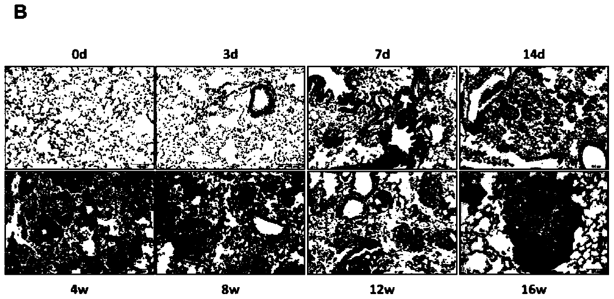 Improving method for preparing mouse silicosis model