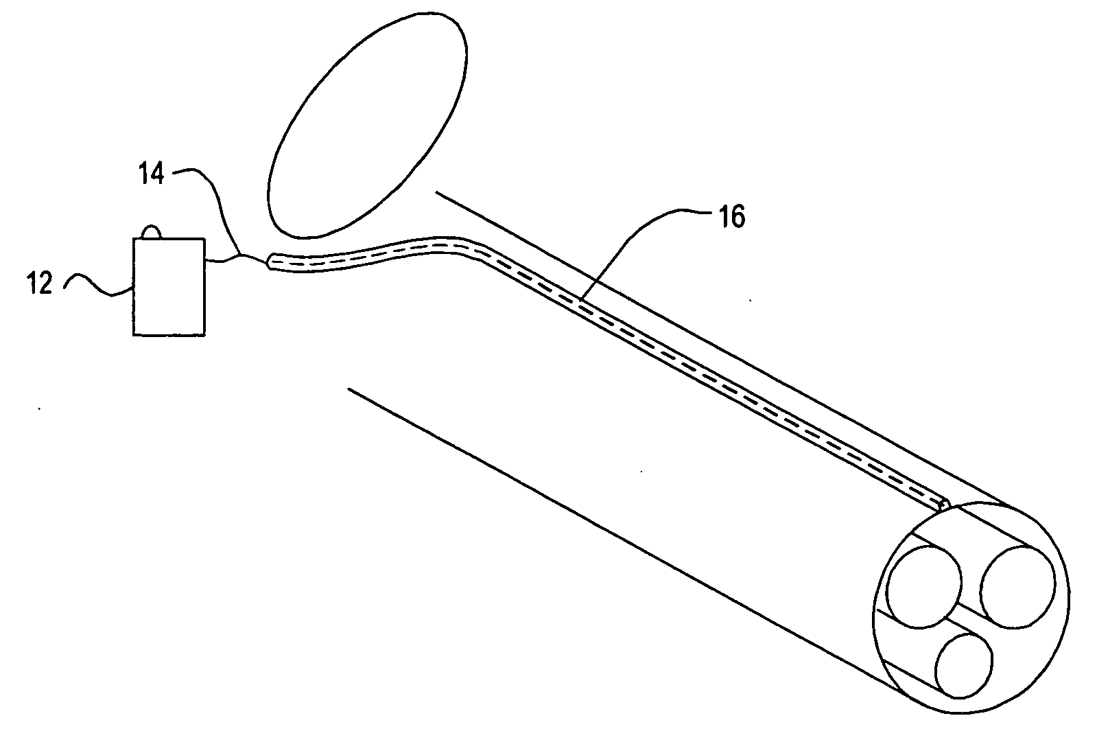 Implantable device and method for managing erectile dysfunction