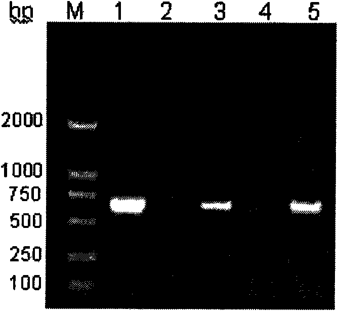 Method and kits for detecting genotype of hepatitis B virus