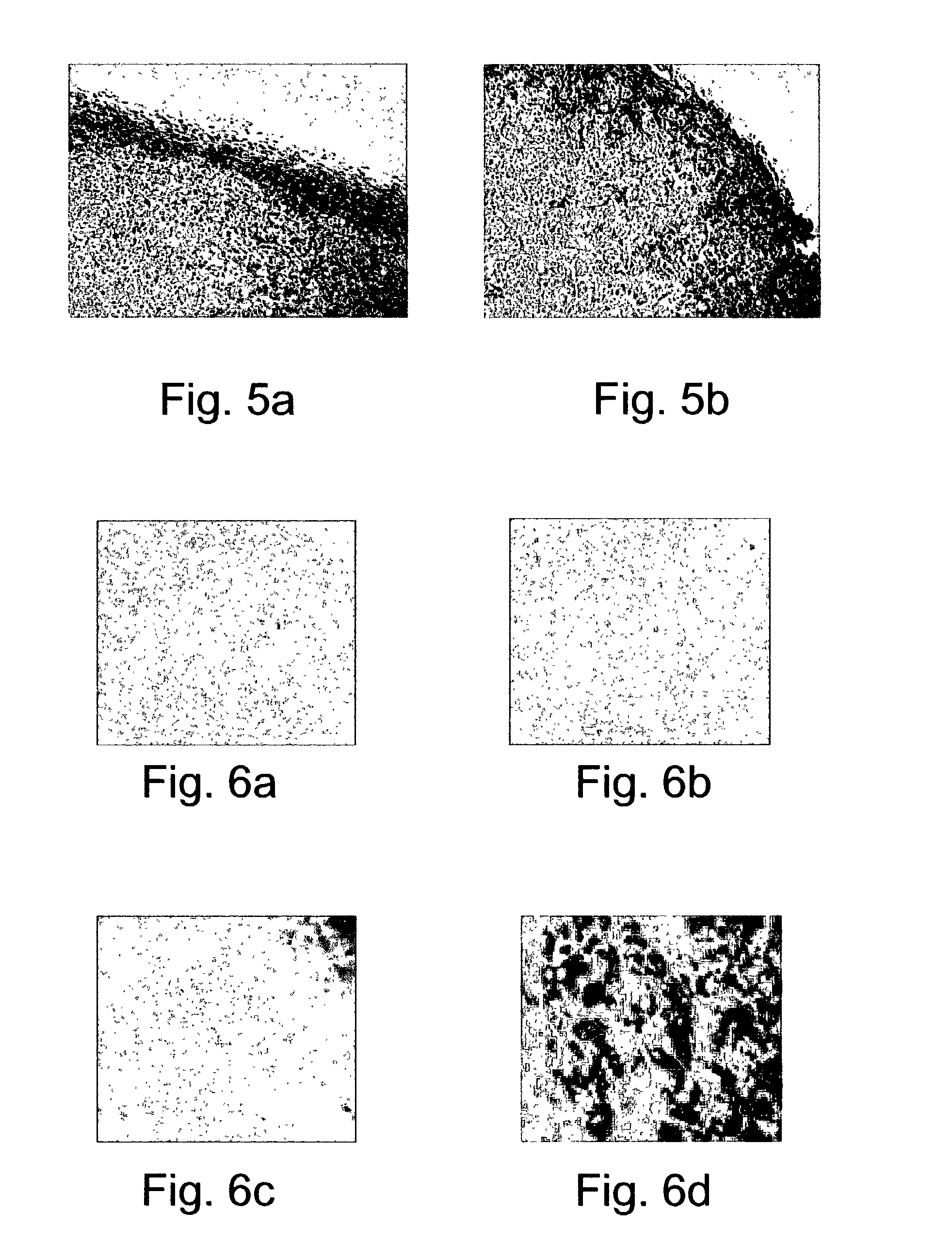 Pharmaceutical compositions and methods useful for modulating angiogenesis and inhibiting metastasis and tumor fibrosis