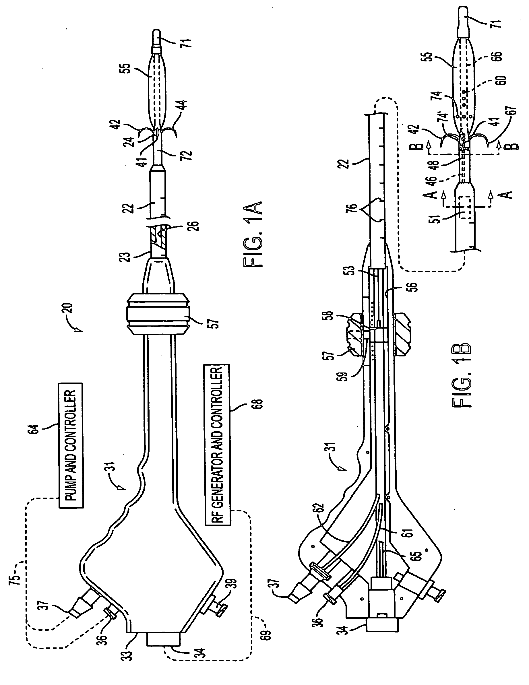 Apparatus and methods for treating female urinary incontinence