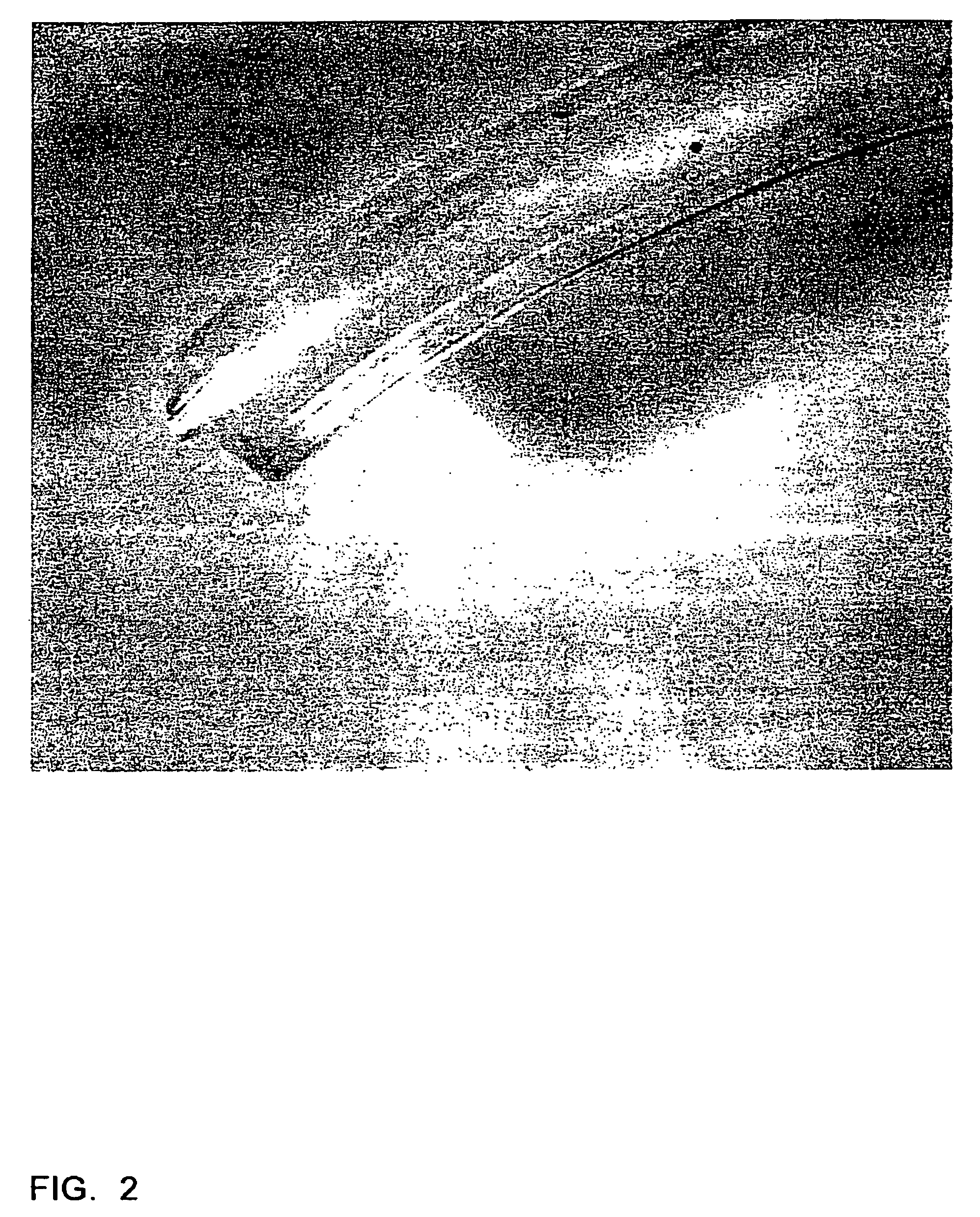 Dry mouldable drug formulation