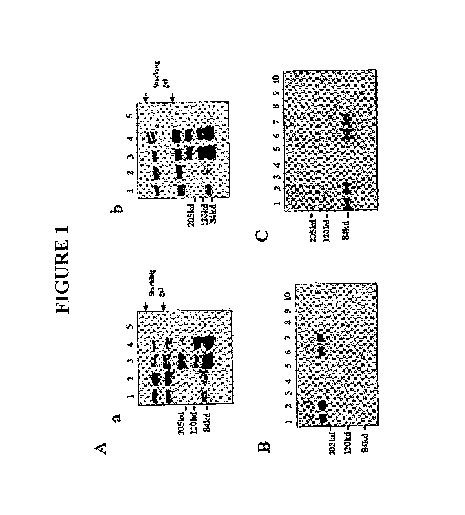 Methods and pharmaceuticals compositions for treating coronary artery disease, ischemia,and vascular disease using angiopoietins