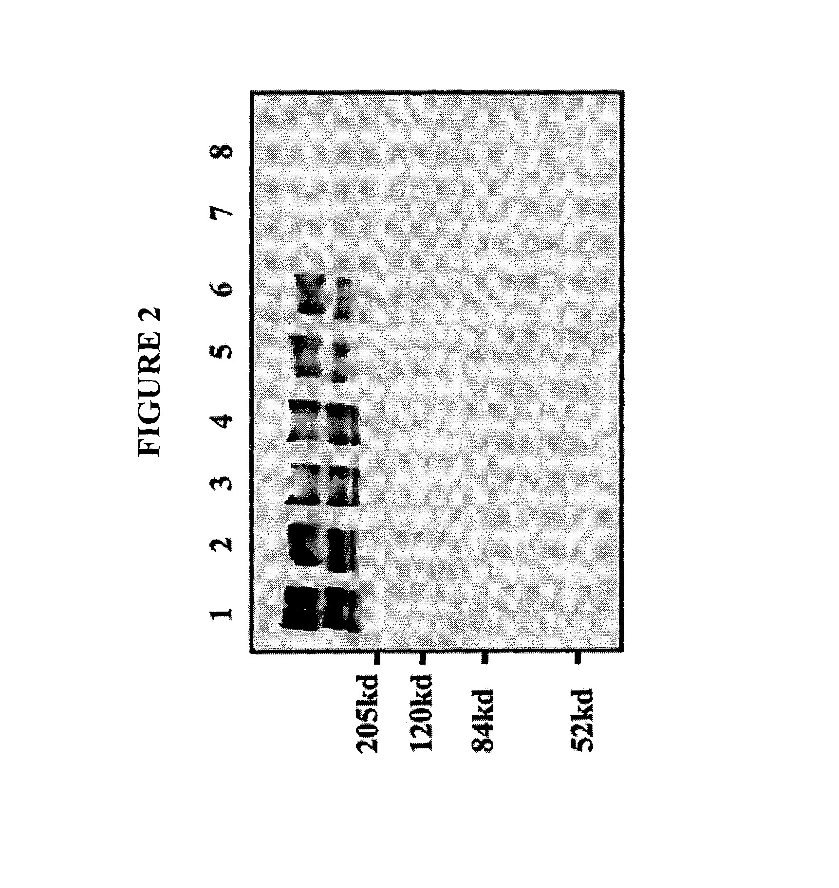 Methods and pharmaceuticals compositions for treating coronary artery disease, ischemia,and vascular disease using angiopoietins