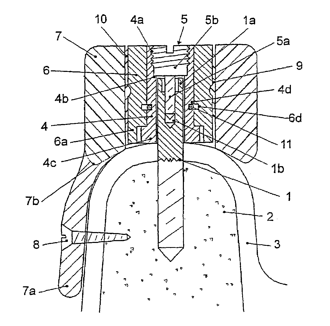 Positioning device for fitting implant-supported dental prostheses