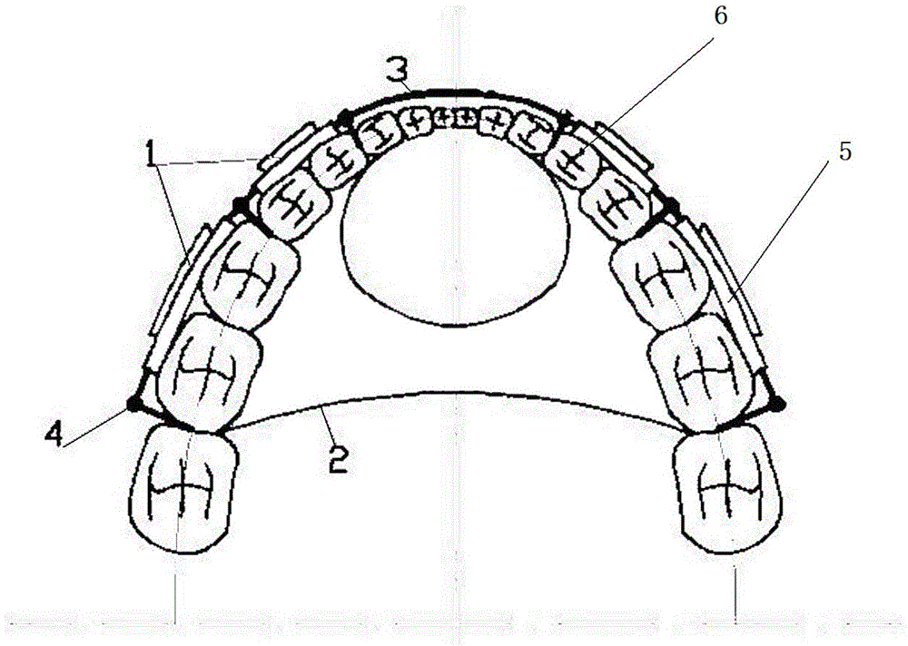 Eccentric shaft semi-fixed snoring device