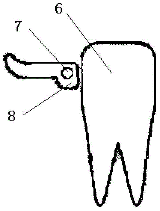 Eccentric shaft semi-fixed snoring device