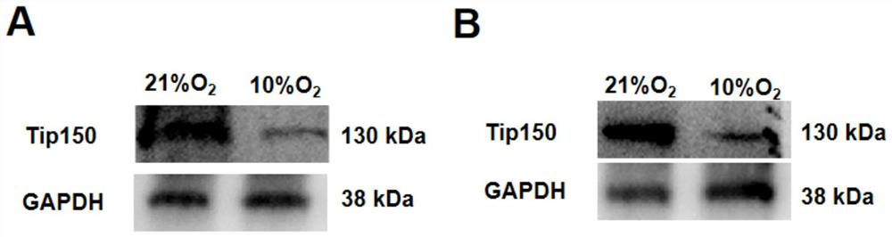 Application of Tip150 protein agonist in hypoxia flagellum multiple morphological abnormality