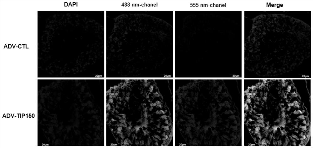 Application of Tip150 protein agonist in hypoxia flagellum multiple morphological abnormality