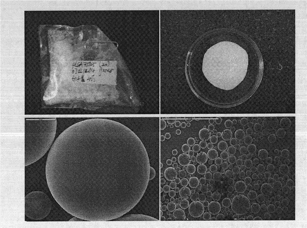 Preparation method and application of fibrin glue composite recombinant human bone morphogenetic protein-2 (rhBMP-2) microsphere