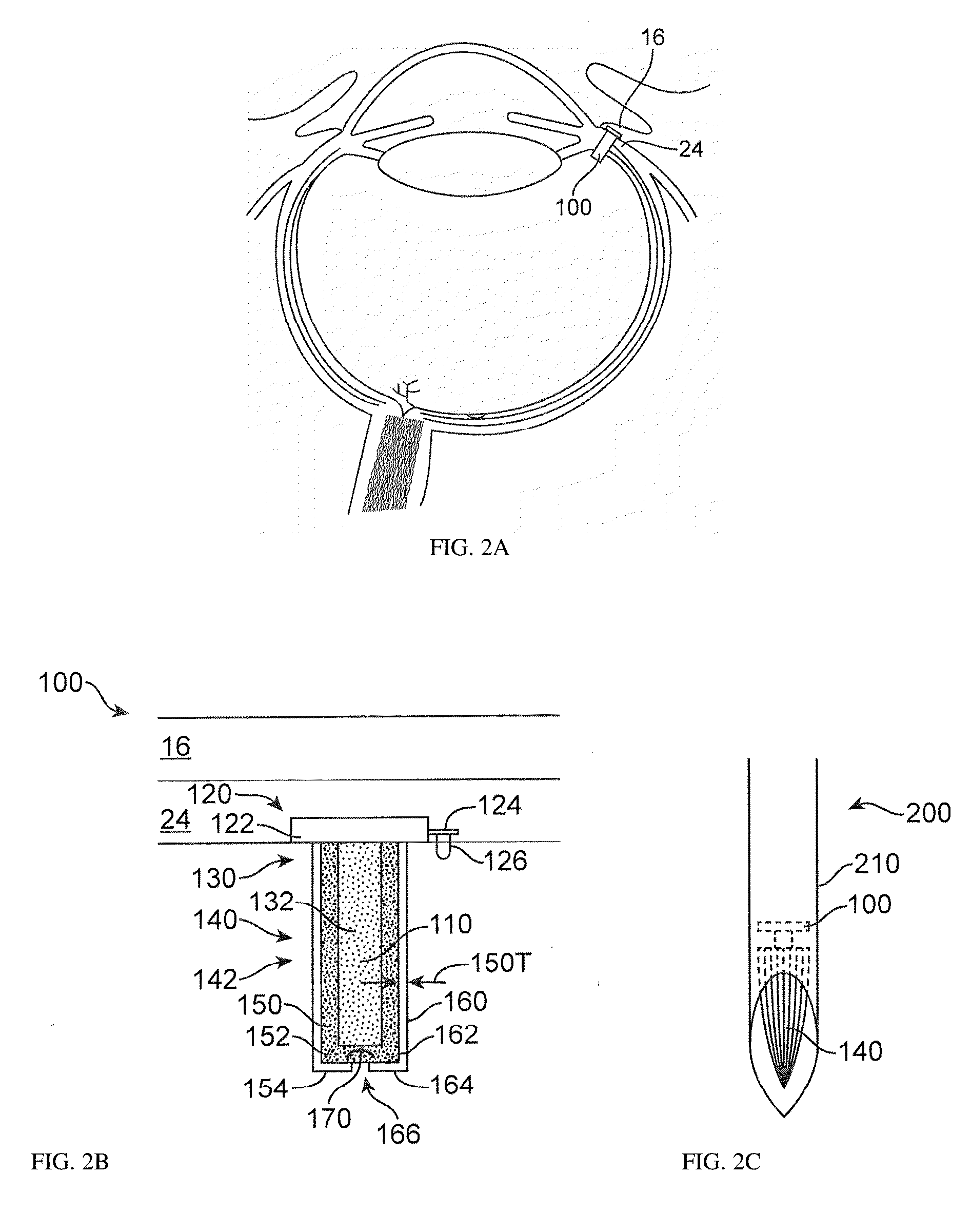 Stable and Soluble Formulations of Receptor Tyrosine Kinase Inhibitors, and Methods of Preparation Thereof