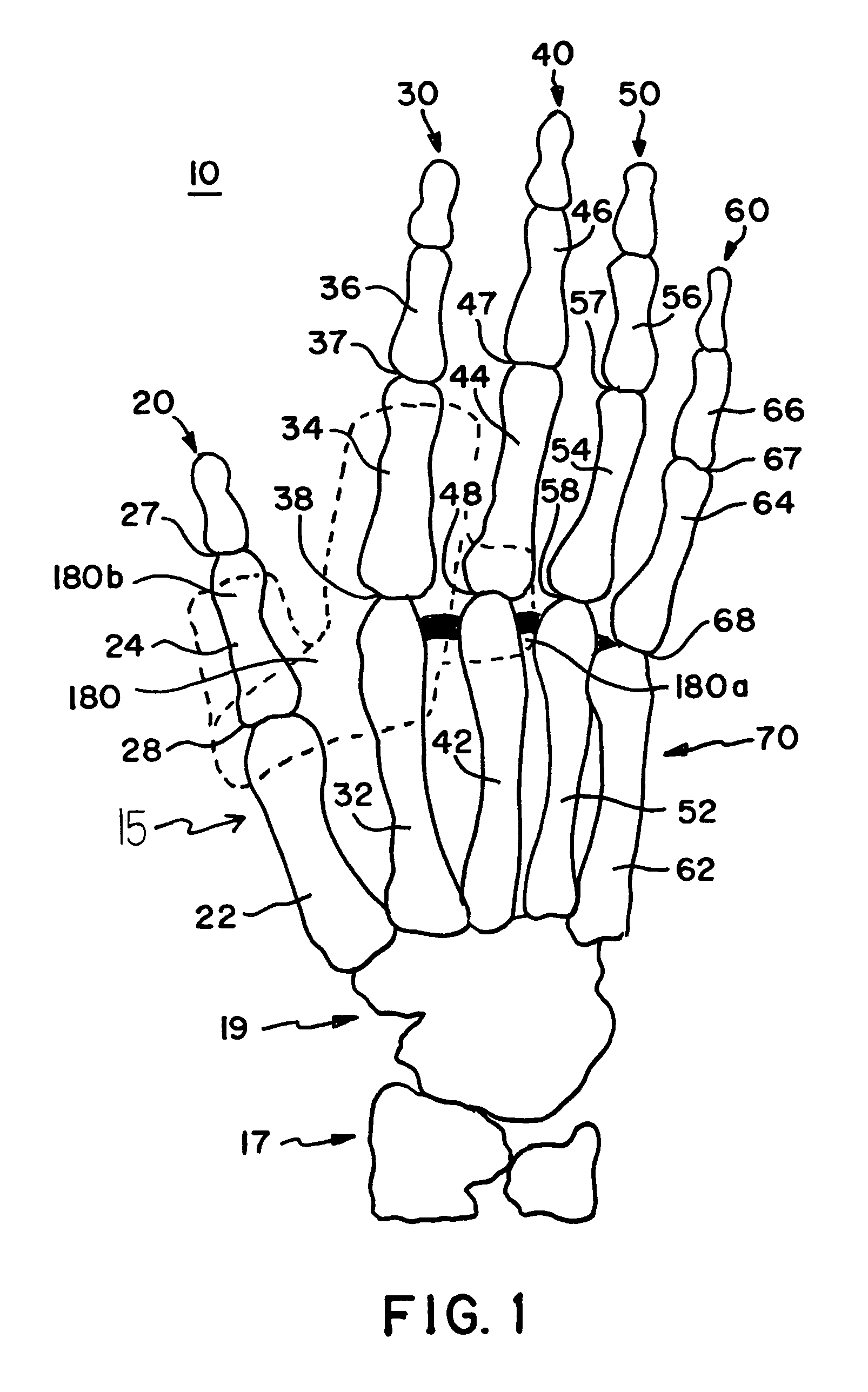 Sports glove with padding