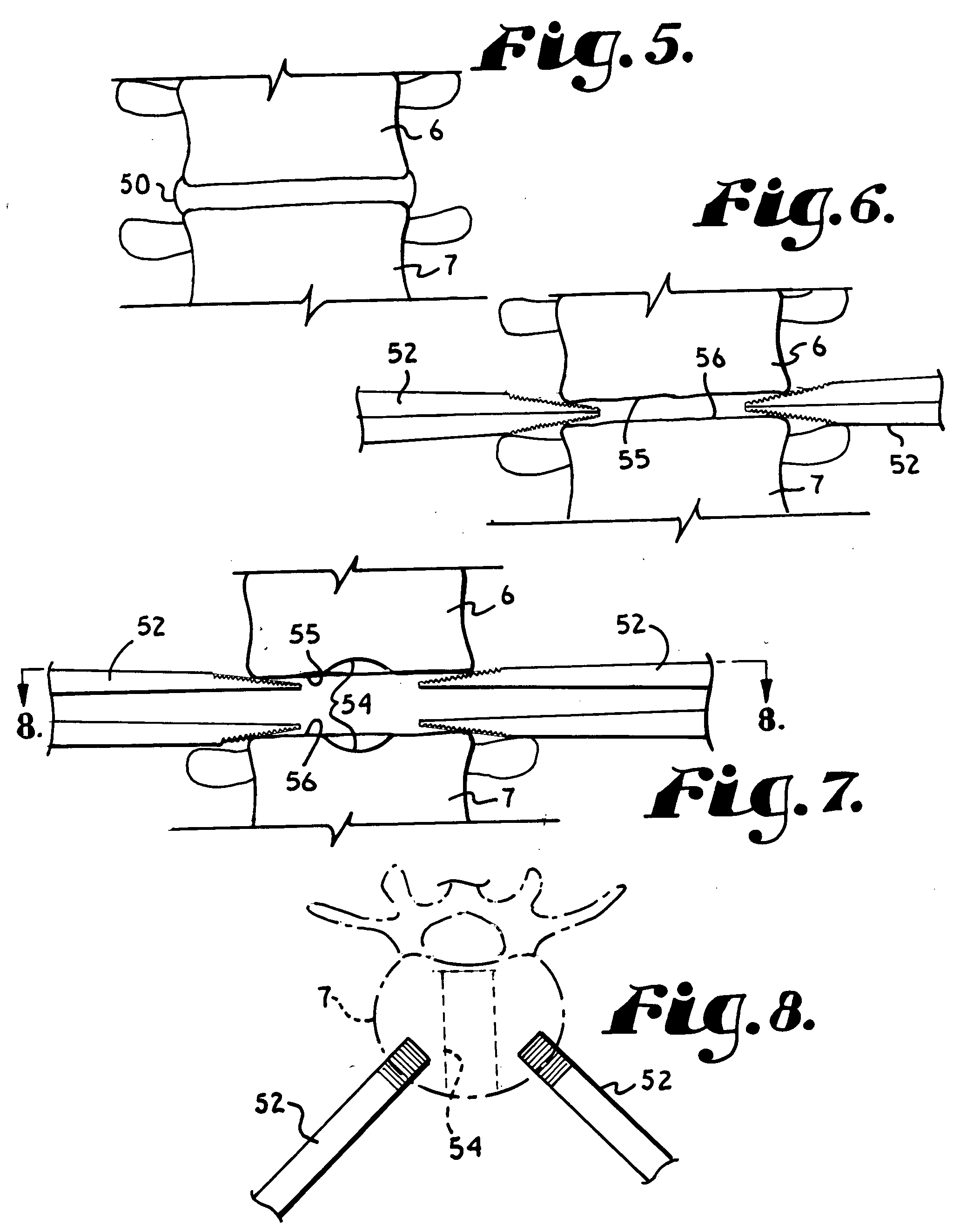 Threaded center line cage with funnel shaped profile