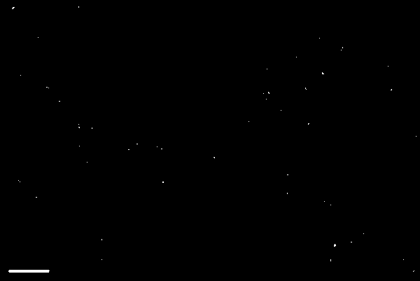 Preparation method of detection probe for alpha-synuclein accumulation as well as product and application of detection probe