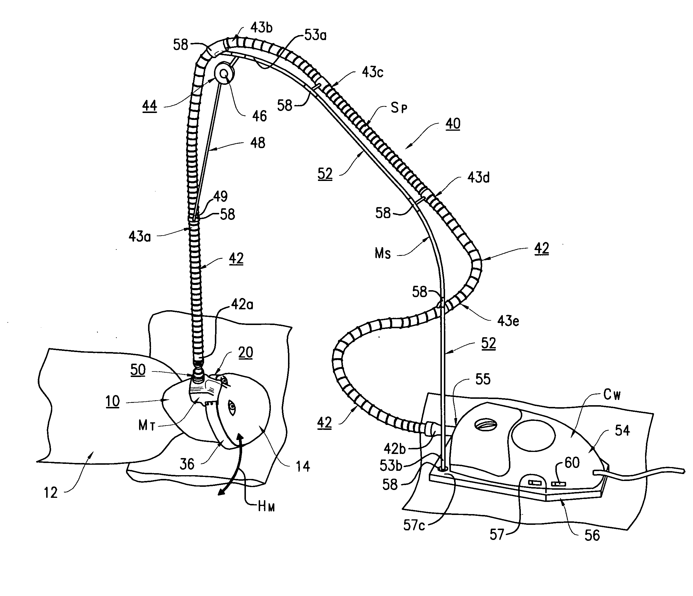 Nose mask assembly to be worn during sleep having a suspension support bracket and a retractable line