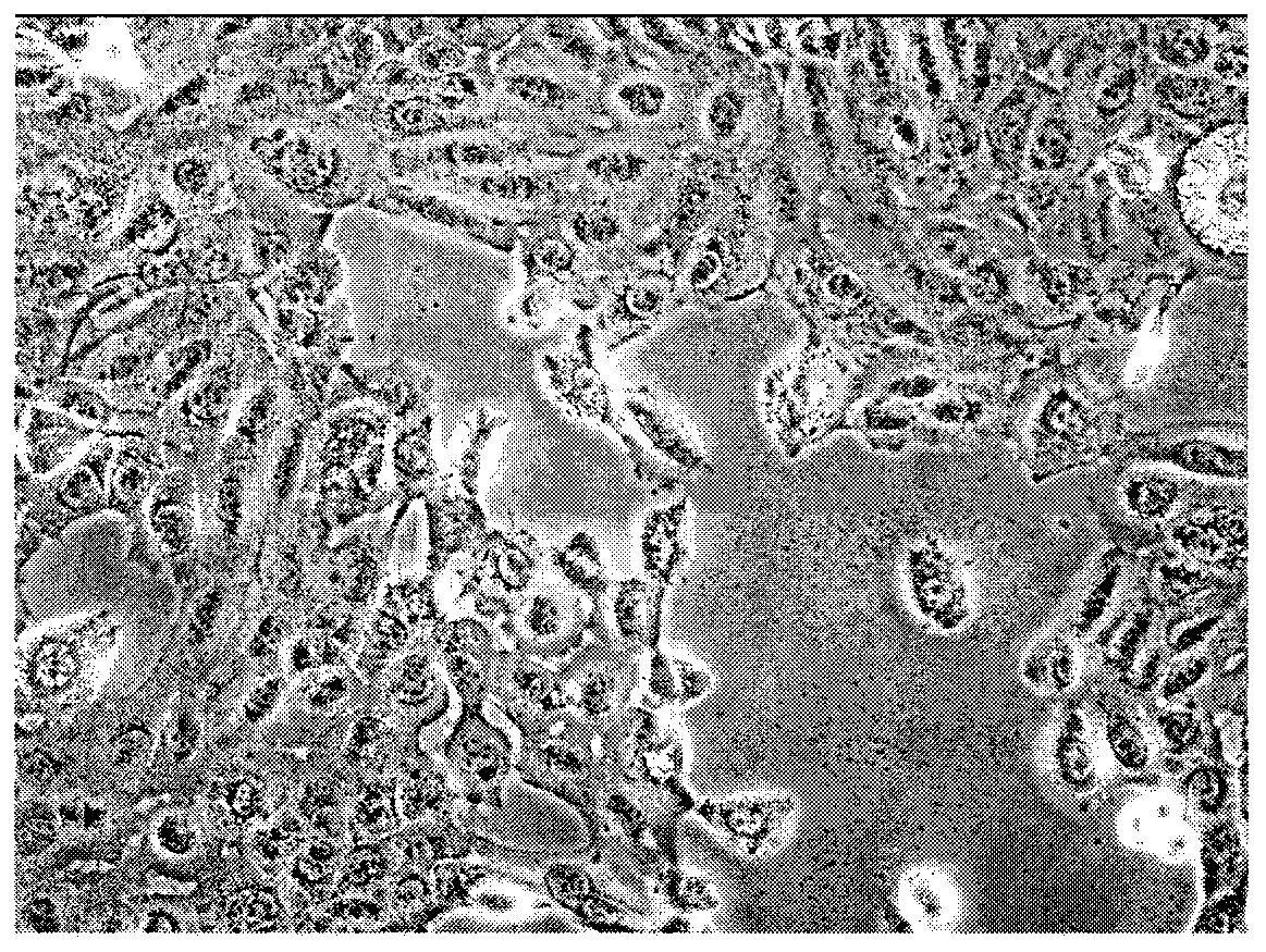 A hpv-negative penile squamous cell carcinoma cell line carrying tp53 mutation and its use