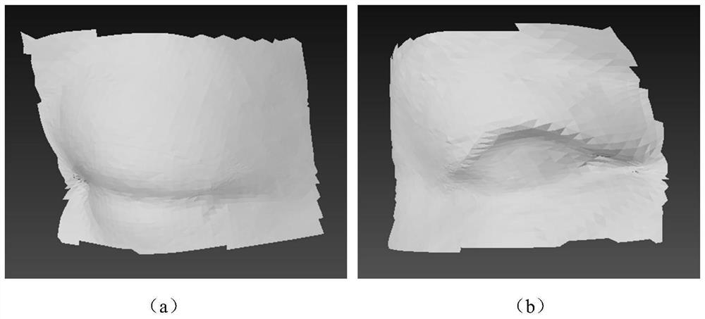 Key point information-based method and system for evaluating orbital soft tissue morphology and equipment