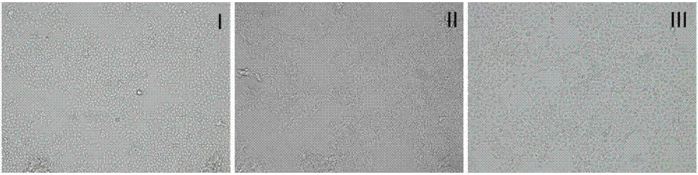 Method for rapidly separating and culturing human bronchial epithelial cells, and optimized medium