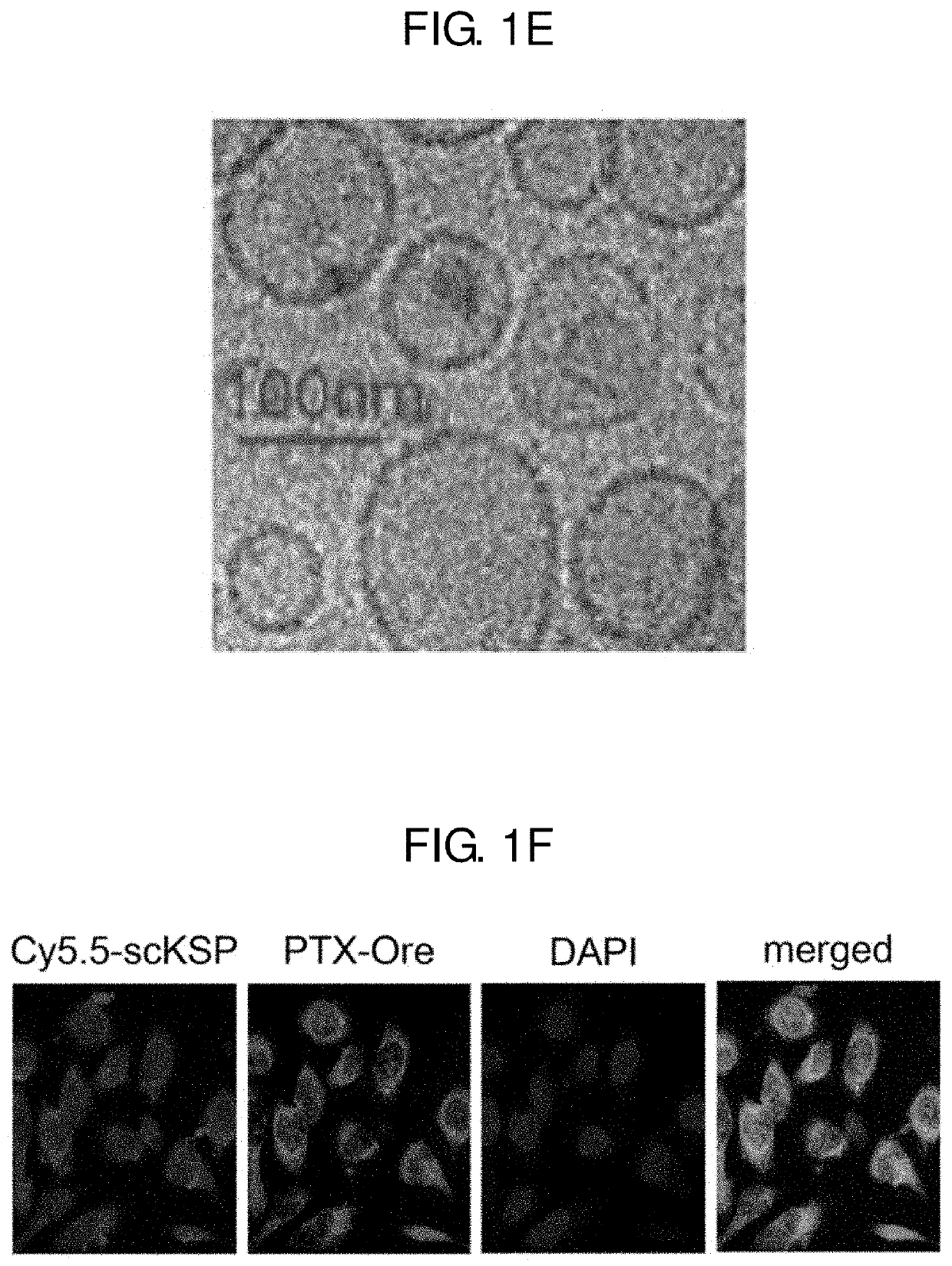 Pharmaceutical composition for preventing or treating cancer comprising ksp inhibitor and mitosis inhibitor