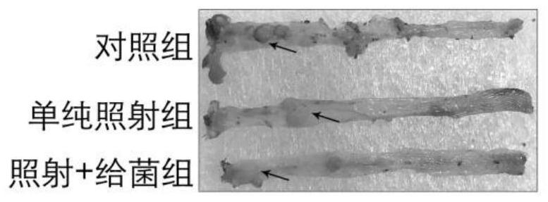 Application of intestinal Rosebariella in preparation of tumor radiosensitizer