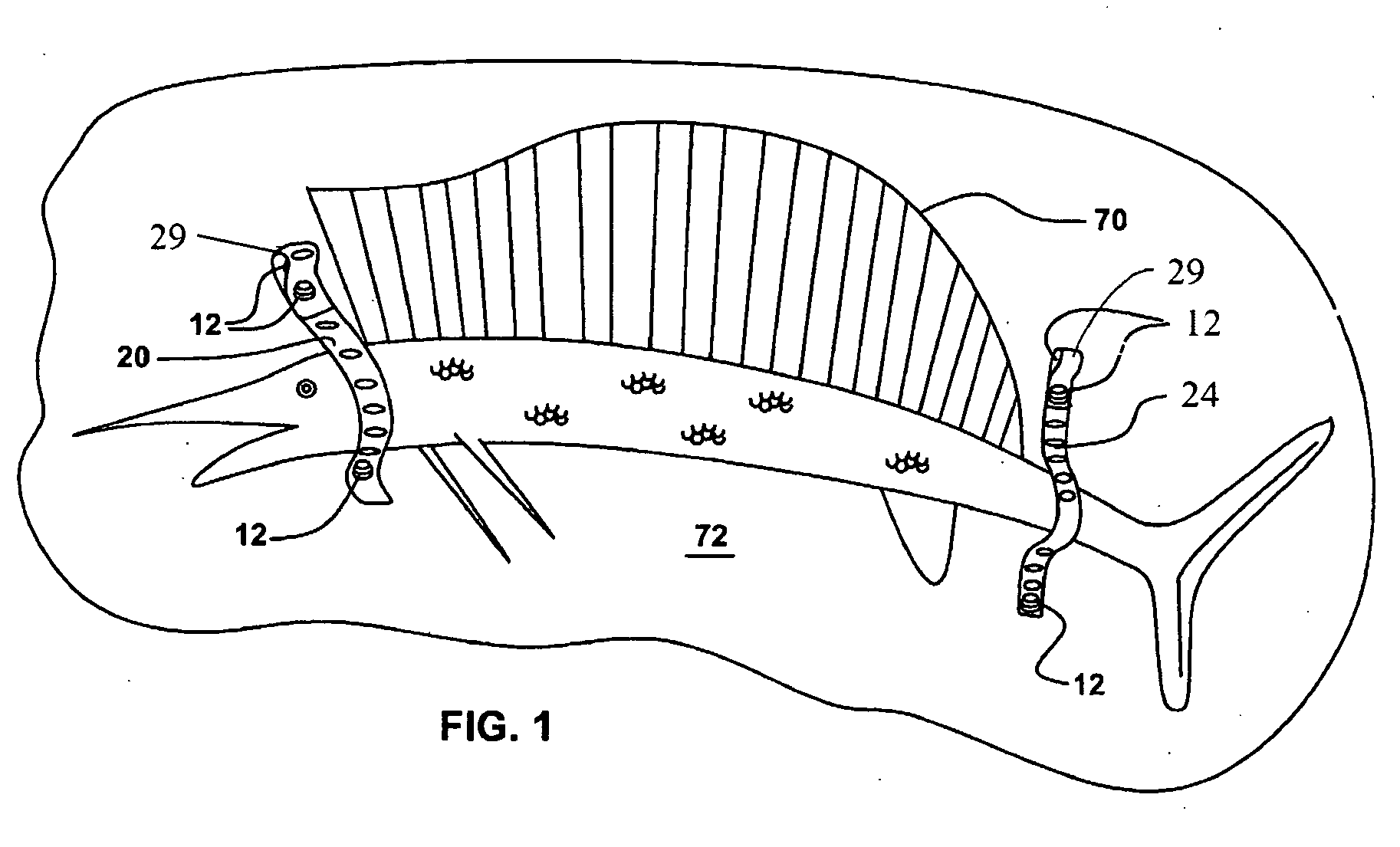 Flexible support apparatus