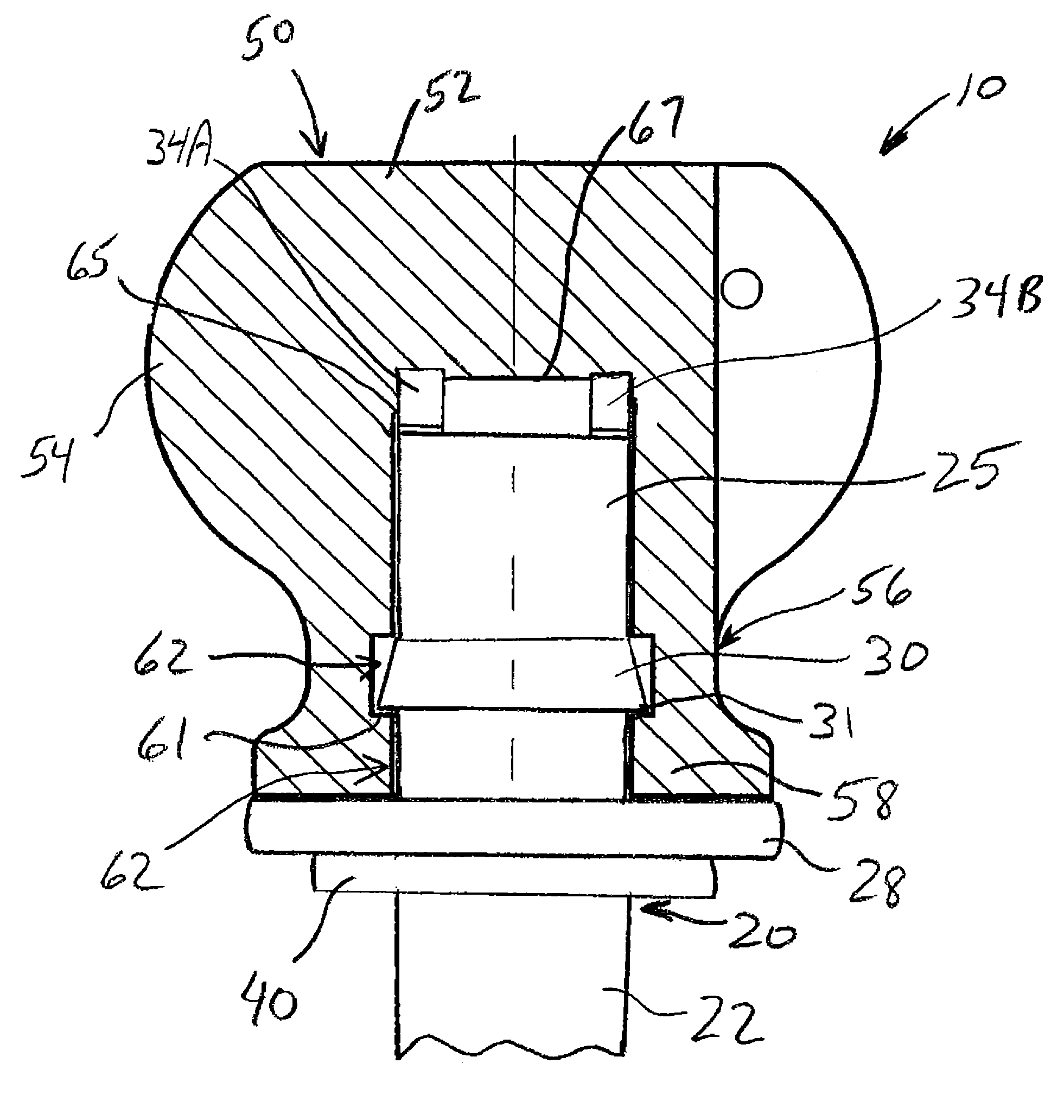 Ulnar head prosthesis system