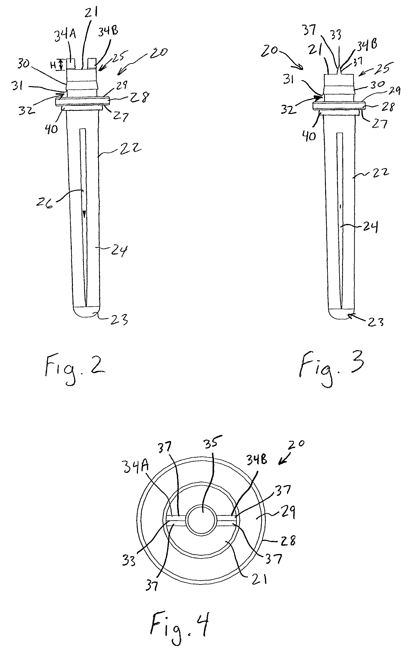 Ulnar head prosthesis system