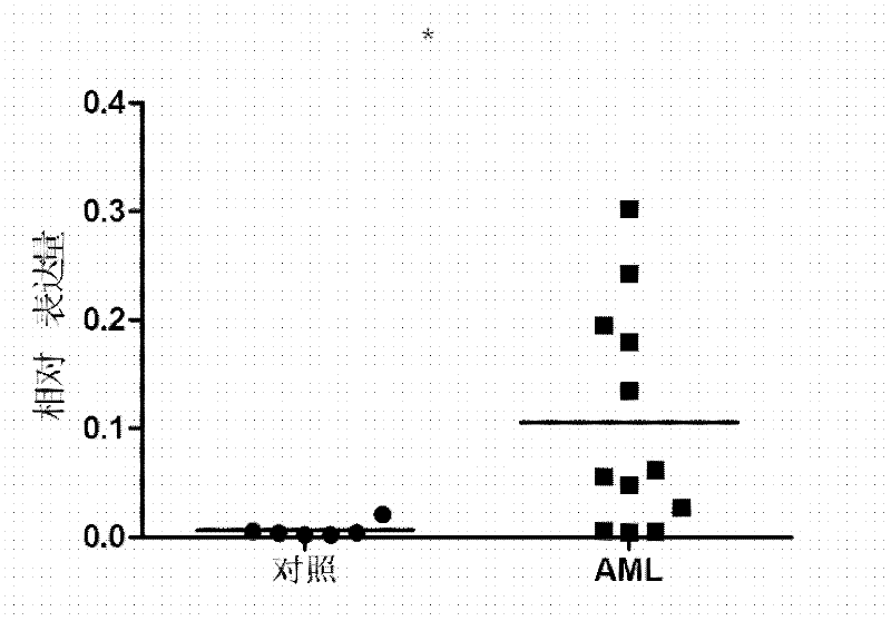 Kit for diagnosing acute myelocytic leukemia