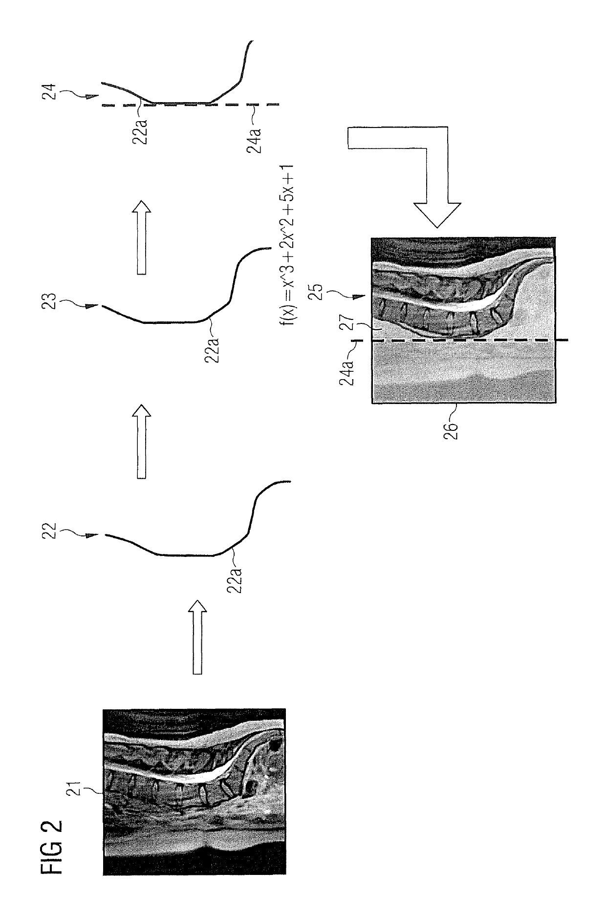 Magnetic resonance data acquisition method and apparatus saturation with spin dependent on the anatomical structures to be imaged