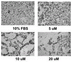 Novel bipropoxyphenyl-methylsulfonylamide compound for adjusting activity of estrogen-related receptor and medical purpose thereof