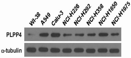 Application of plpp4 as a target for diagnosis, treatment and prognosis of non-small cell lung cancer