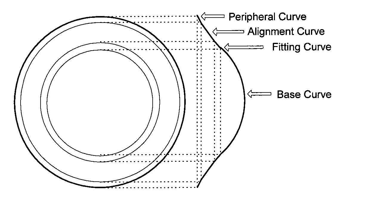 Orthokeratology lens wear combined with chemical treatment to correct myopia, hyperopia or astigmatism