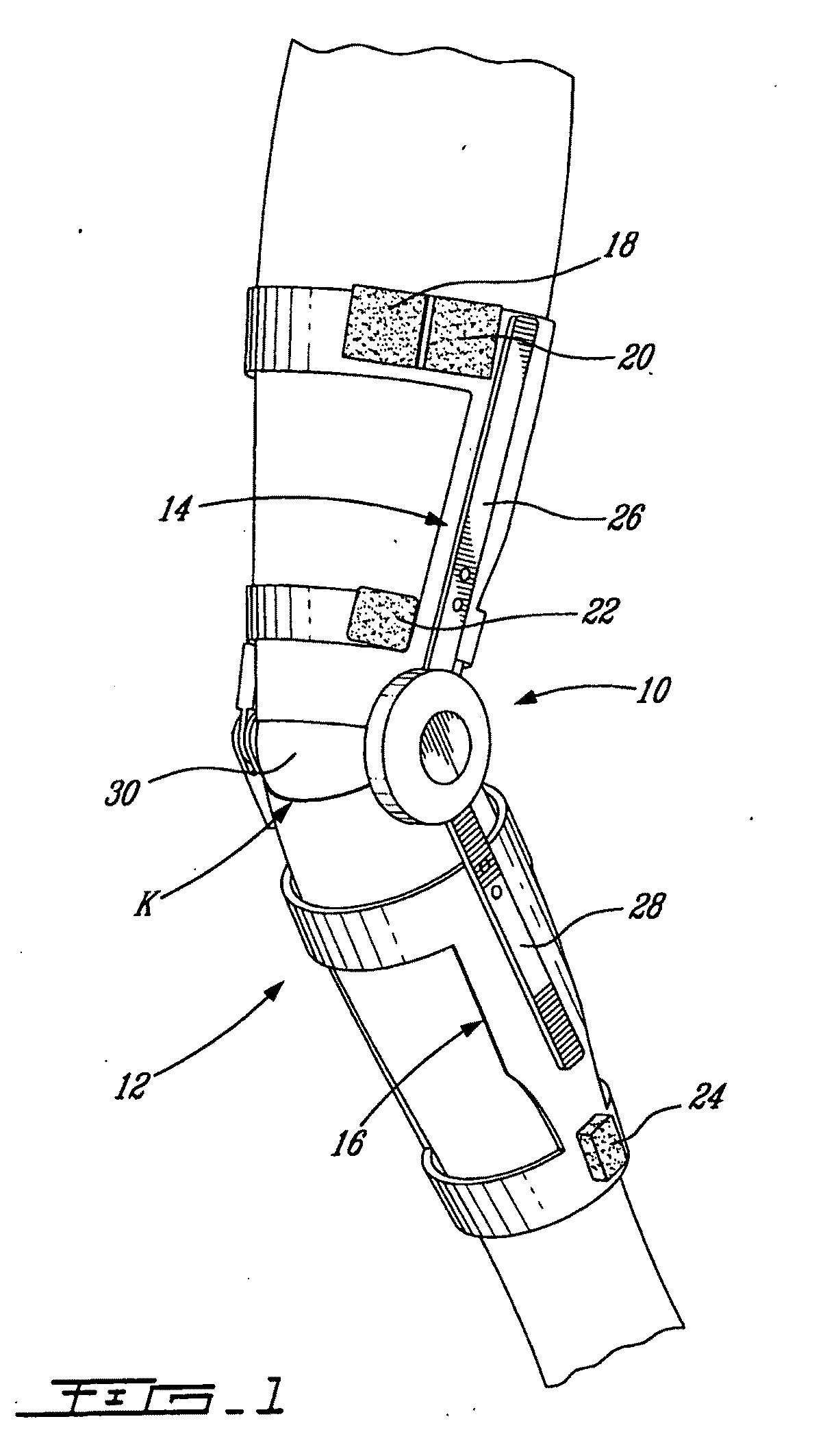 High Torque Active Mechanism for Orthotic and/or Prosthetic Devices