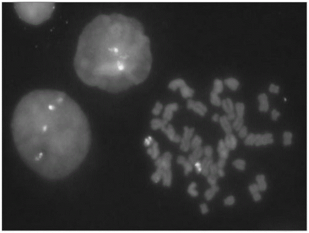 HER-2 gene and / or TOP2A gene detection probe and preparation method and kit