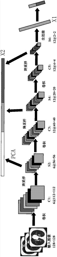 Pulmonary nodule feature extraction method based on convolutional neural network and principal component analysis