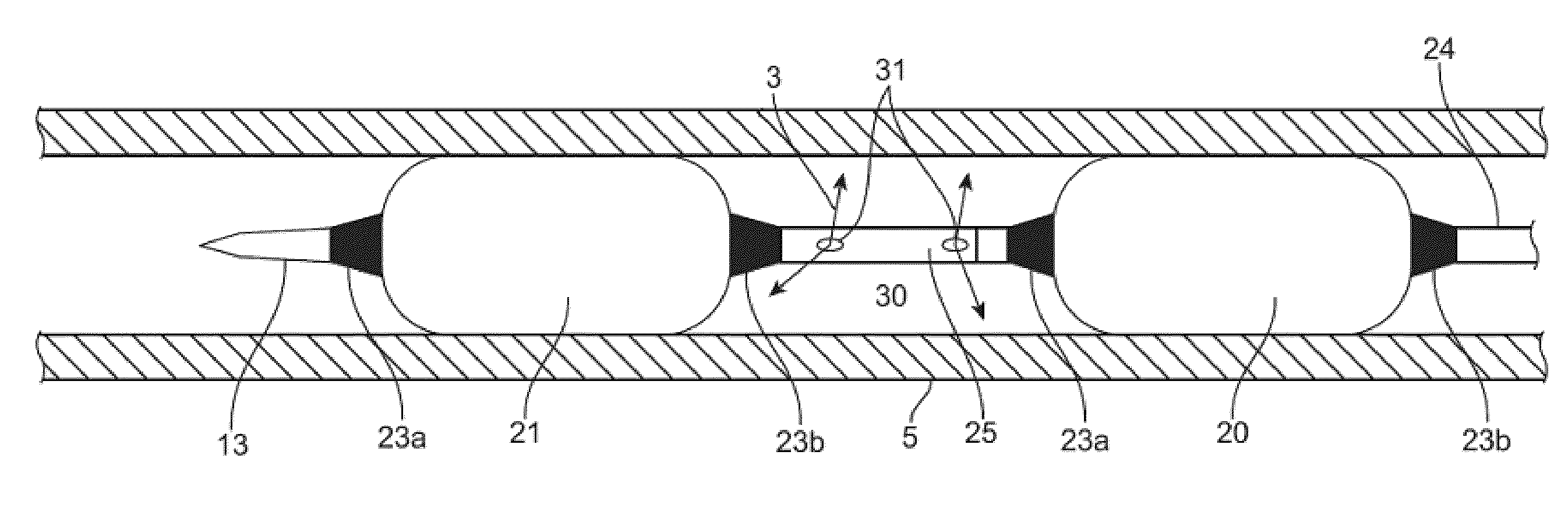 Double balloon catheter and methods for homogeneous drug delivery using the same