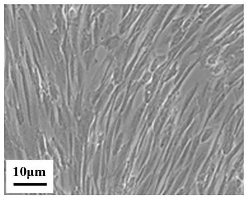 Application of glycoside dipeptide conditioned medium in cryopreservation of mesenchymal stem cells and preparation of commercial cryopreservation agents