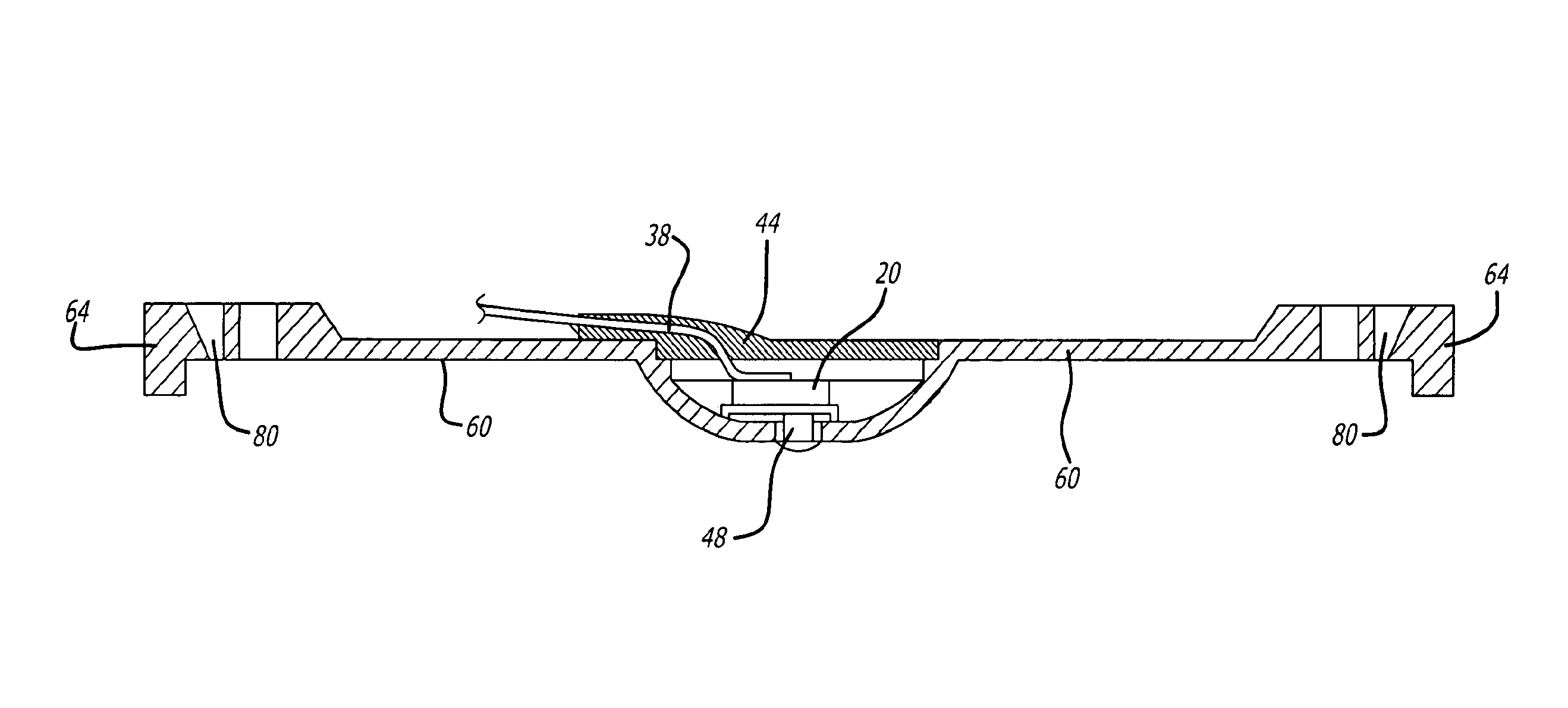 Uterine contraction sensing system and method