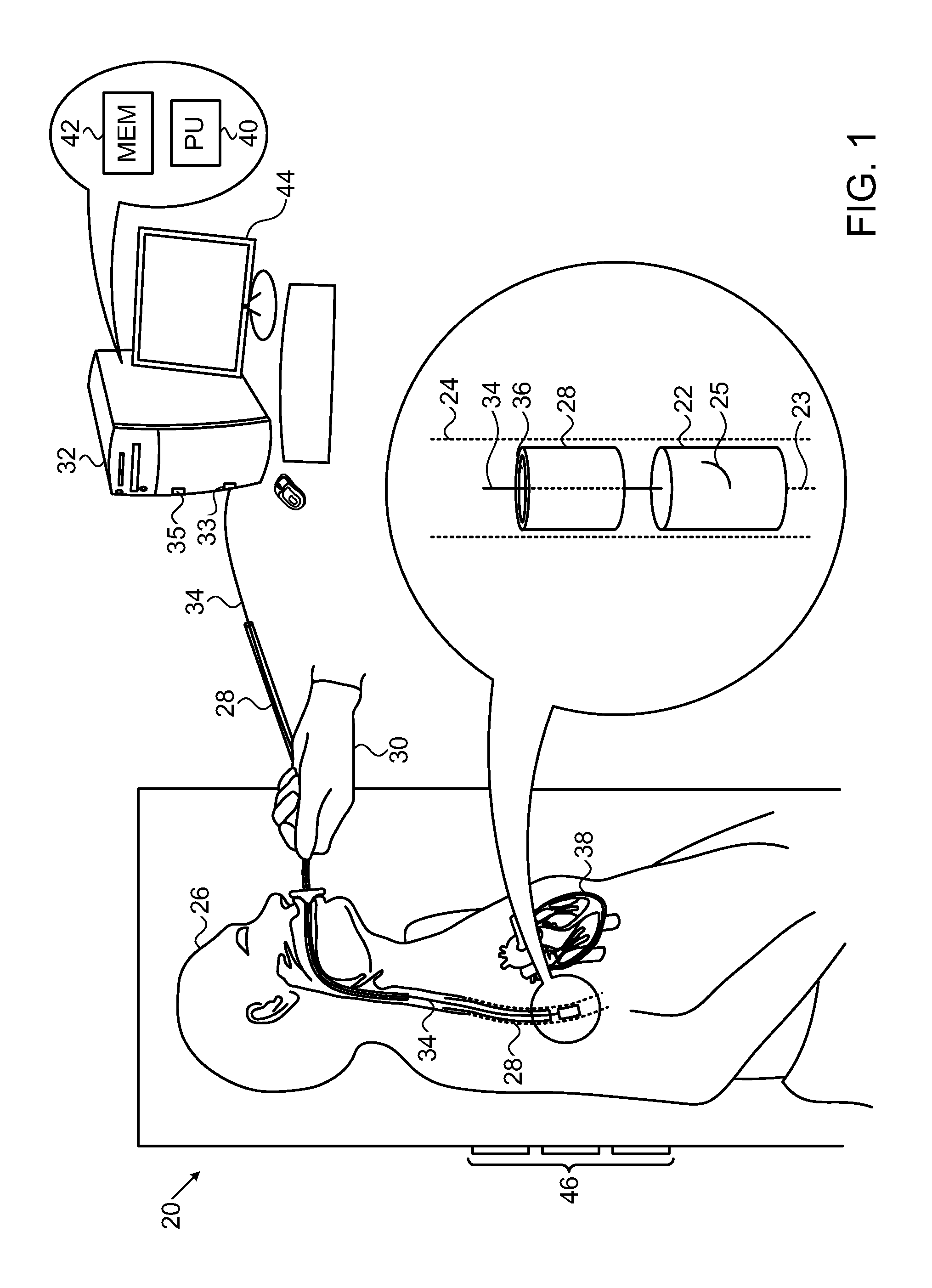 Transesophageal echocardiography capsule