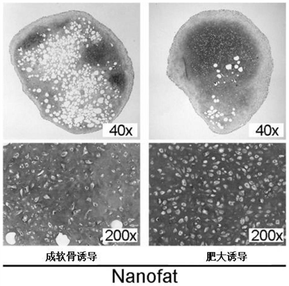 Method for directly preparing acellular hypertrophic cartilage matrix from adipose tissue