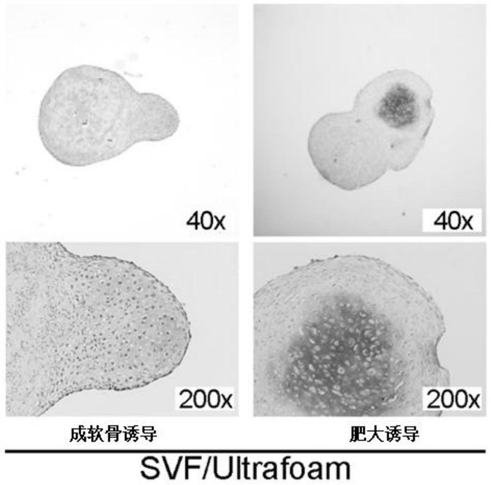 Method for directly preparing acellular hypertrophic cartilage matrix from adipose tissue