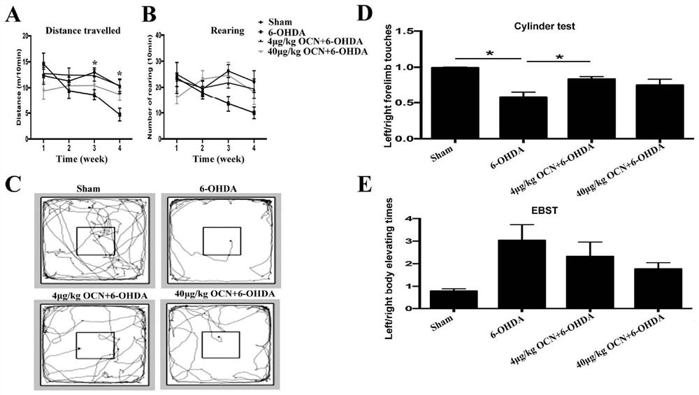 Application of osteocalcin in preparing medicine for treating Parkinson's disease